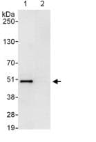 Trip13 Pch2 Antibody Ab128171  Immunoprecipitation Img131138