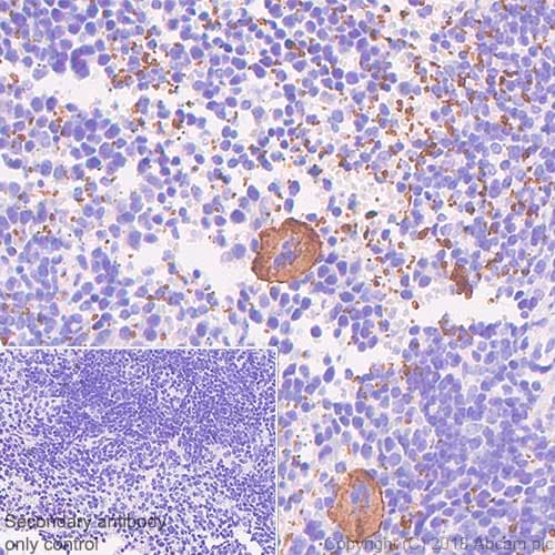Anti-CD42b antibody [SP219](AB183345)