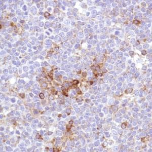 Vpac1 Antibody Sp234 Ab183312  Immunohistochemistry Formalin Pfa Fixed Paraffin Embedded Sections Img138914