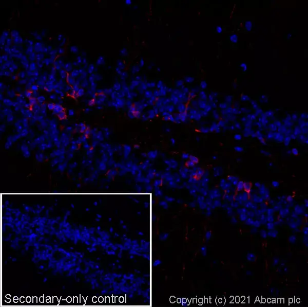 Anti-Doublecortin antibody(AB18723)