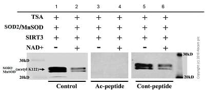 Anti-SOD2/MnSOD (acetyl K122) antibody [NCI-R156-33] - BSA and Azide free(AB240391)