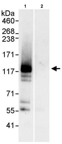 Xpc Antibody Ab245384  Immunoprecipitation Img66641
