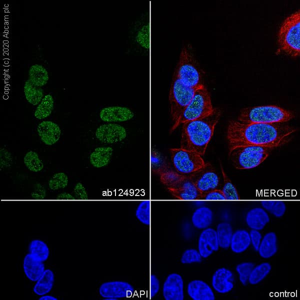 Tls Fus Antibody Epr5812 Ab124923  Immunocytochemistry Immunofluorescence Img172505
