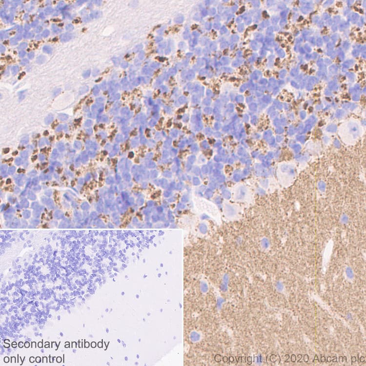 Anti-SYT2 + SYT1 antibody [EPR23920-2](AB259977)