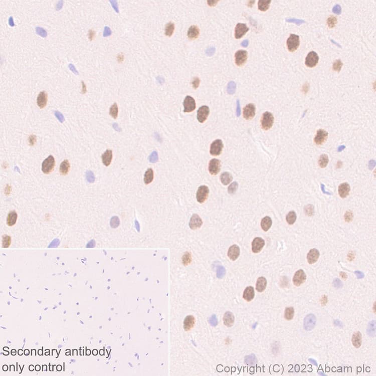 Anti-Homeobox protein cut-like 2 antibody [EPR26509-79](AB315796)