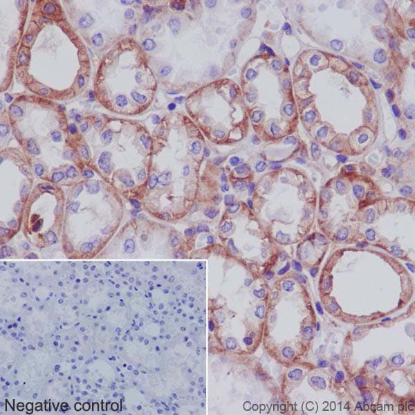 Anti-Integrin alpha V antibody [EPR16800](AB179475)