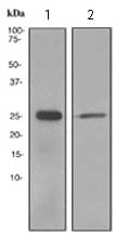 Tppp Antibody Epr3315 Ab119987  Western Blot Img160147