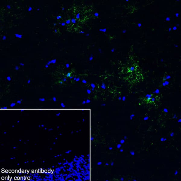 Anti-GPCR GPR17 antibody [EPR26423-34](AB316105)