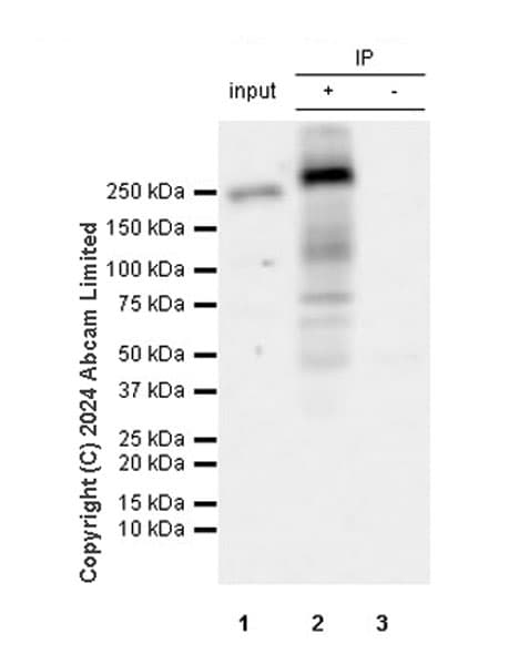 Mtor Antibody Rm1258 Ab322444  Immunoprecipitation Img438205