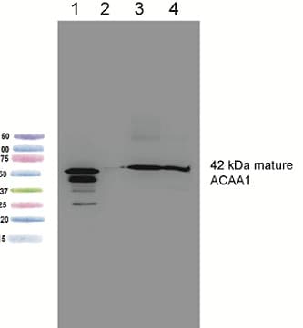 Acaa1 Beta Ketothiolase Antibody 2h6be7 Ab110289  Western Blot Img39418