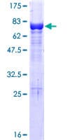 Ab162109  Sds Page Img36561
