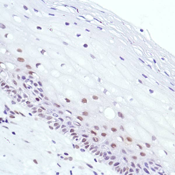 Anti-Cyclin D3/CCND3 antibody [SP207] - BSA and Azide free(AB245734)