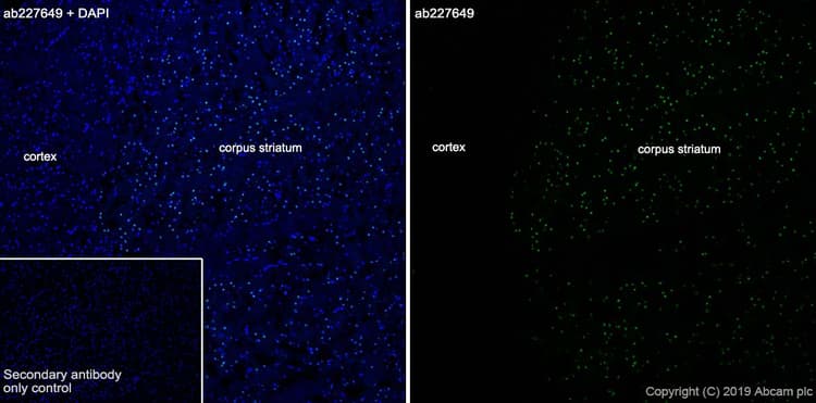 Anti-FOXP1 antibody [SP133] - C-terminal(AB227649)