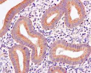 Kbtbd11 Antibody Epr100562b Bsa And Azide Free Ab249501  Immunohistochemistry Formalin Pfa Fixed Paraffin Embedded Sections Img41488
