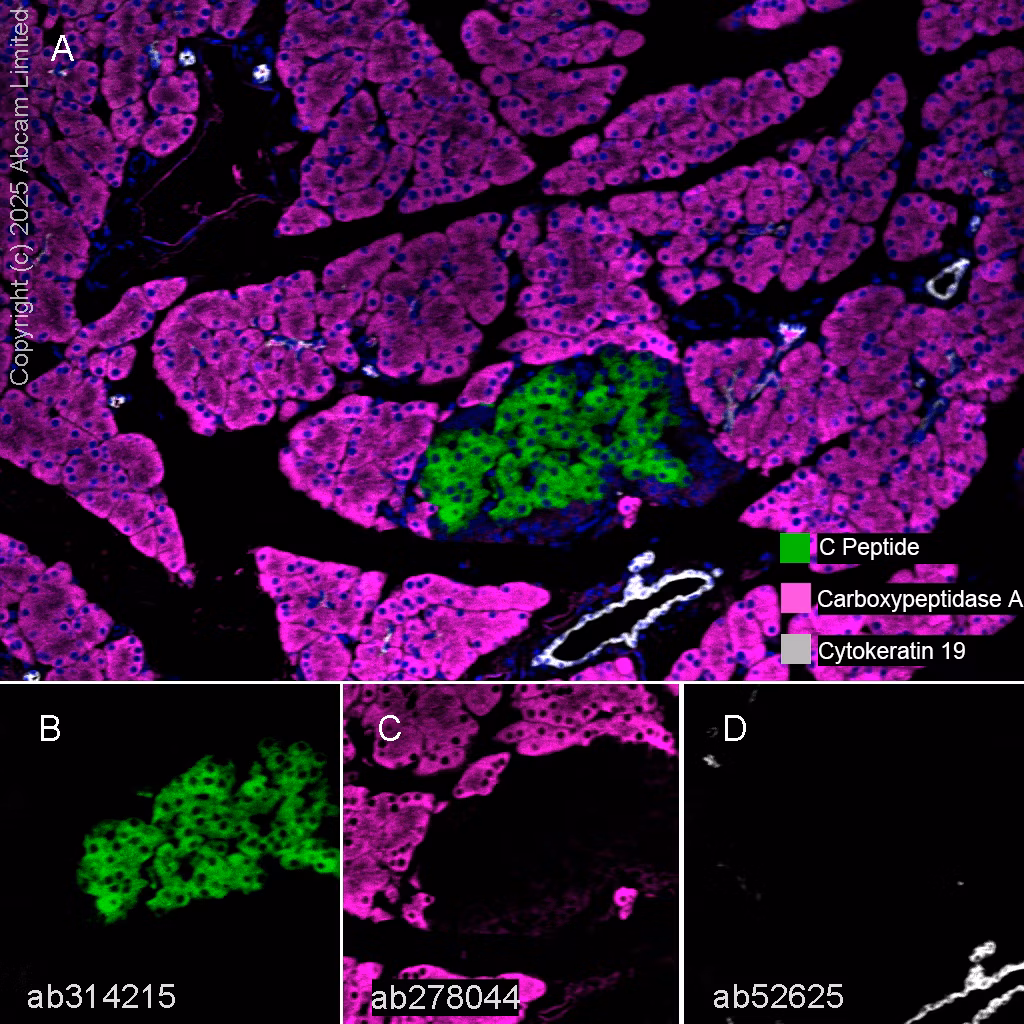 Cytokeratin 19 Antibody Ep1580y Cytoskeleton Marker Ab52625 Multiplex Immunohistochemistry Img447478