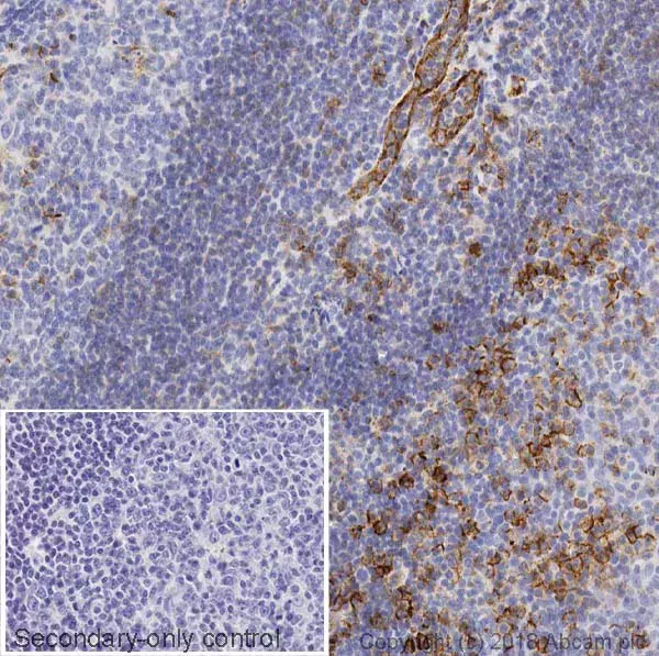 Anti-CD31 antibody [JC/70A](AB9498)