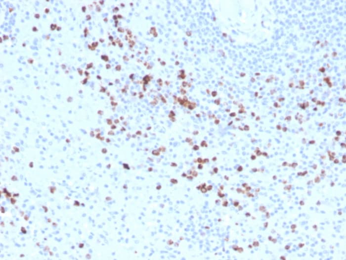 Biotin Granzyme B Antibody Gzmb 3014 Ab271818  Immunohistochemistry Formalin Pfa Fixed Paraffin Embedded Sections Img118814