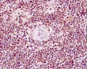 Anti-PBK/SPK (phospho T9) antibody [EPR2475(N)](AB184953)