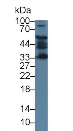 Anti-ACD antibody(AB231330)