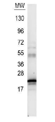 Anti-IL-6 antibody(AB6672)
