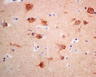 Anti-Syntenin antibody [EPR8102](AB133267)