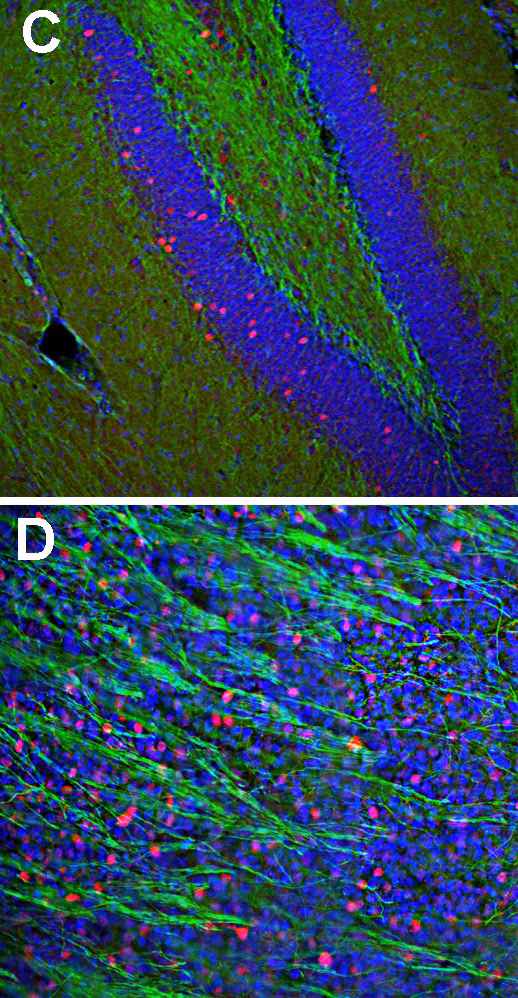 C Fos Antibody Bsa Free Ab190289 Immunohistochemistry Free Floating Img27878