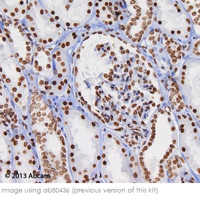 Mouse and Rabbit Specific HRP/DAB IHC Detection Kit - Micro-polymer(AB236466)
