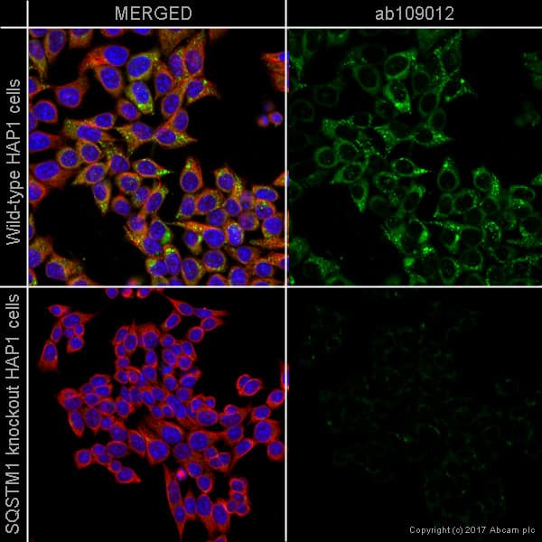 Autophagy Analysis (ATG16L1, ATG16L1 pS278, SQSTM1, LC3B, Ubiquitin, M6PR) Antibody Sampler Panel(AB269811)