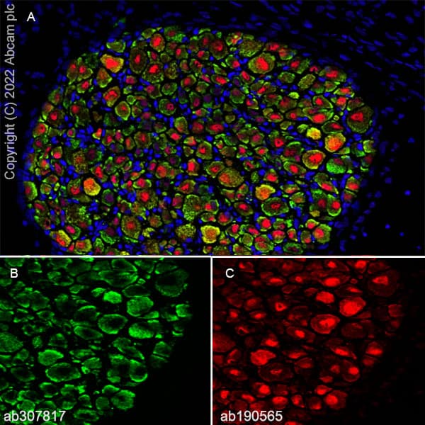 Anti-Nav1.8/SCN10A antibody [EPR25132-222](AB307817)