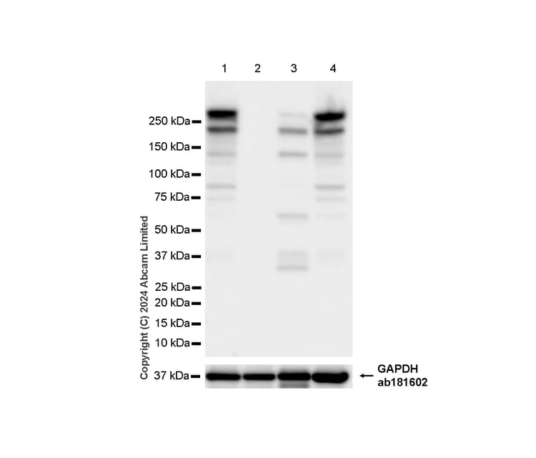 Mtor Antibody Rm1258 Ab322444  Western Blot Img438176