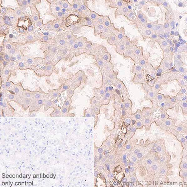 Anti-NUMB antibody [EPR21988] - BSA and Azide free(AB234108)