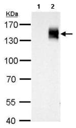 Anti-mCherry antibody(AB183628)