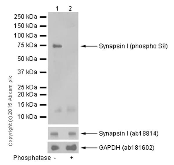 Synapsin I Phospho S9 Antibody Ep2162y Ab76260  Western Blot Img20721