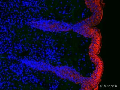 Anti-wide spectrum Cytokeratin antibody(AB9377)