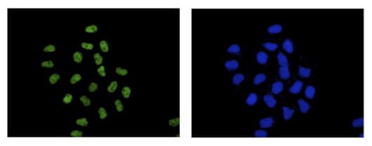 Eftud2 Antibody Epr16055b Ab188327  Immunocytochemistry Immunofluorescence Img63216
