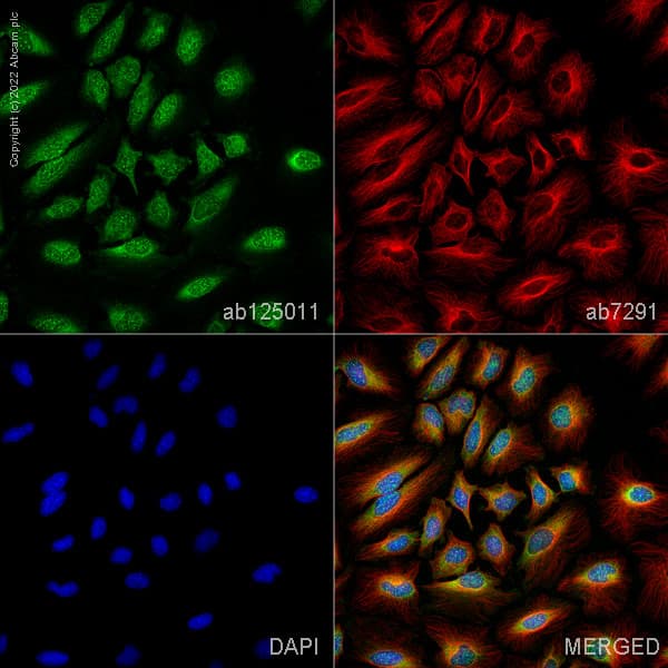 Anti-TSG101 antibody [EPR7130(B)] - Low endotoxin, Azide free(AB216447)