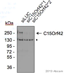 Anti-Treslin antibody(AB124268)