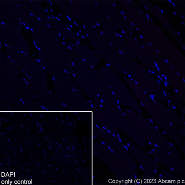 Alexa Fluor® 647 Anti-TBR2 / Eomes antibody [EPR19012](AB315356)