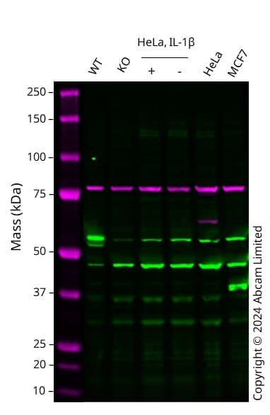 Anti-MMP3 antibody [EP1186Y](AB52915)