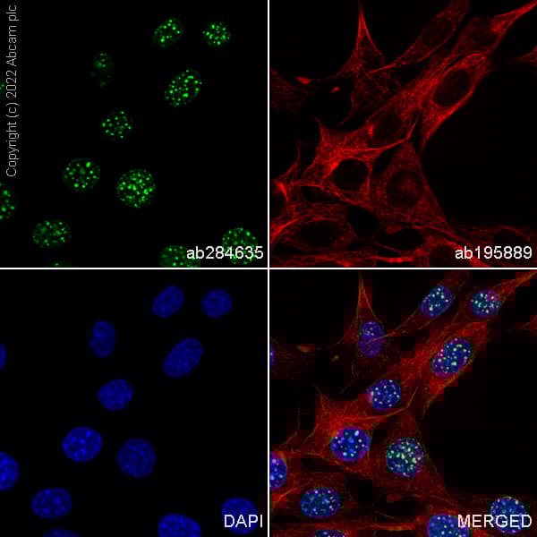 Alexa Fluor® 488 Anti-Histone H3 (tri methyl K9) antibody [EPR16601] - ChIP Grade(AB284635)