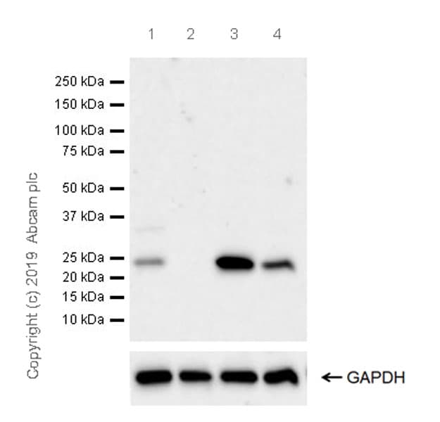 Anti-AICDA antibody [EPR23436-45] - ChIP Grade(ab269454)