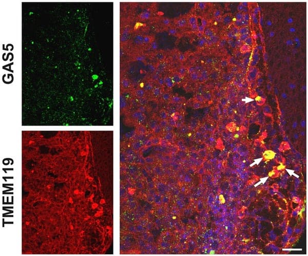 Anti-TMEM119 antibody [28-3] - Microglial marker(AB209064)