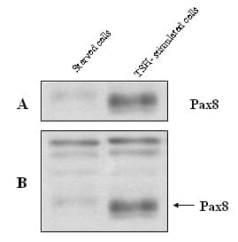 Anti-PAX8 antibody(AB13611)