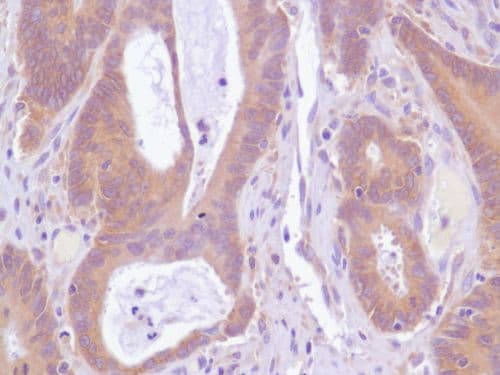 Egfr Antibody Sp84 Bsa And Azide Free Ab238803  Immunohistochemistry Formalin Pfa Fixed Paraffin Embedded Sections Img87753