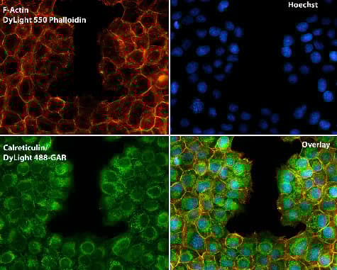 Anti-Calreticulin antibody - ER Marker(AB2907)