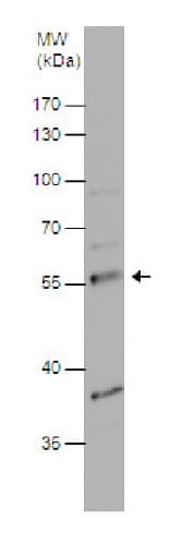 Pdp1 Pdp Antibody Ab228578  Western Blot Img28633