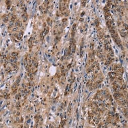 Anti-Interferon alpha 2 antibody(AB198914)