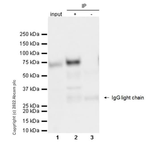 Mouse IgG1, kappa monoclonal [MOPC-21] - isotype control(AB18443)