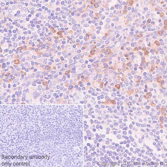 Vpac1 Antibody Sp234 Ab183312  Immunohistochemistry Formalin Pfa Fixed Paraffin Embedded Sections Img6269