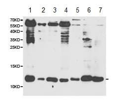 Beta 2 Microglobulin Antibody Ab175031  Western Blot Img17111